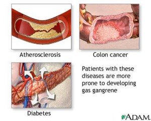 Gangrene