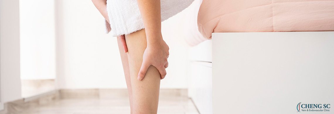 Varicose Vein After Treatment Care