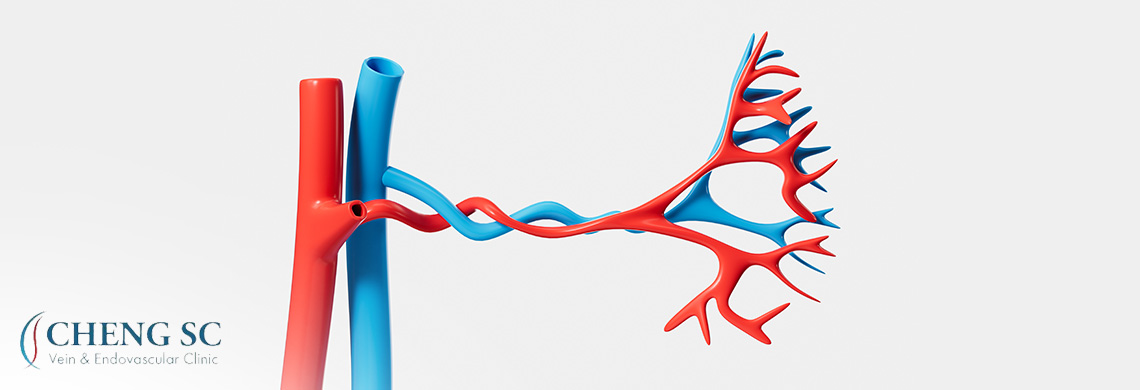 Aneurysm forming in a twisted artery branch structure