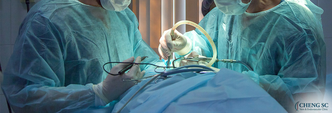 Everything you Need to Know About Endovascular Surgery