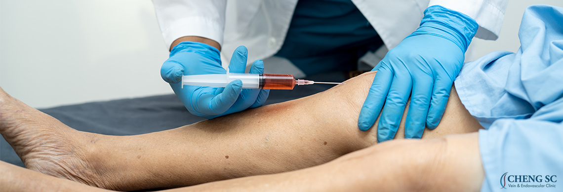 Treatment Deep Dive: Sclerotherapy